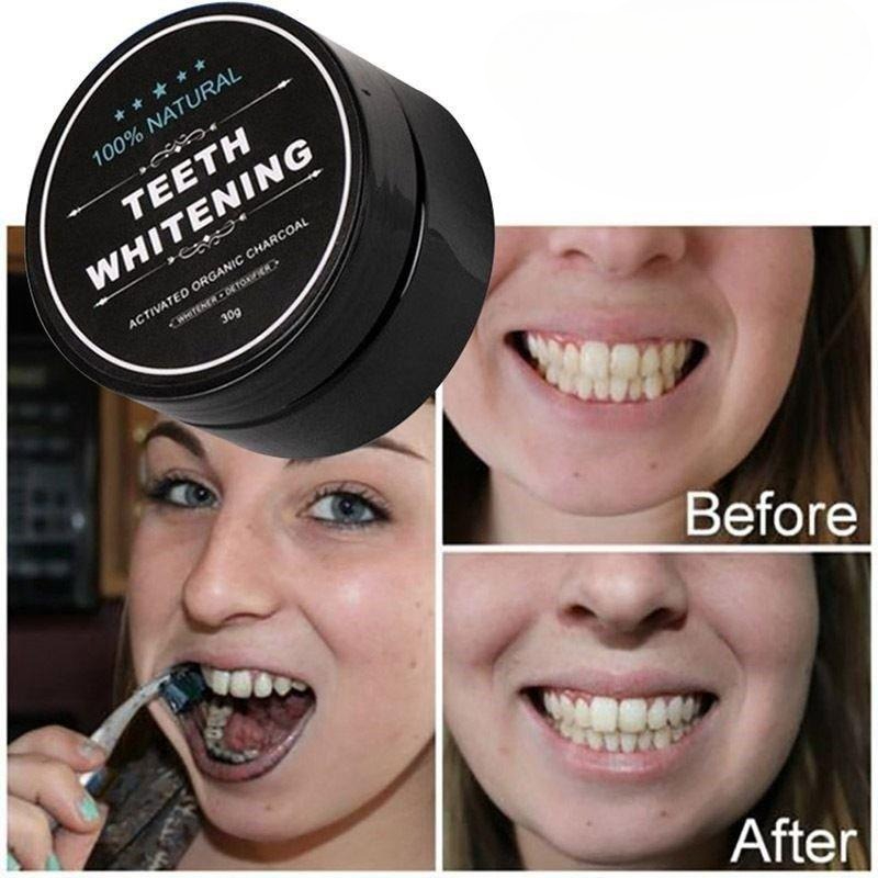 1 doos geactiveerd houtskool t - Teeth Whitening Pens recensie en prijs